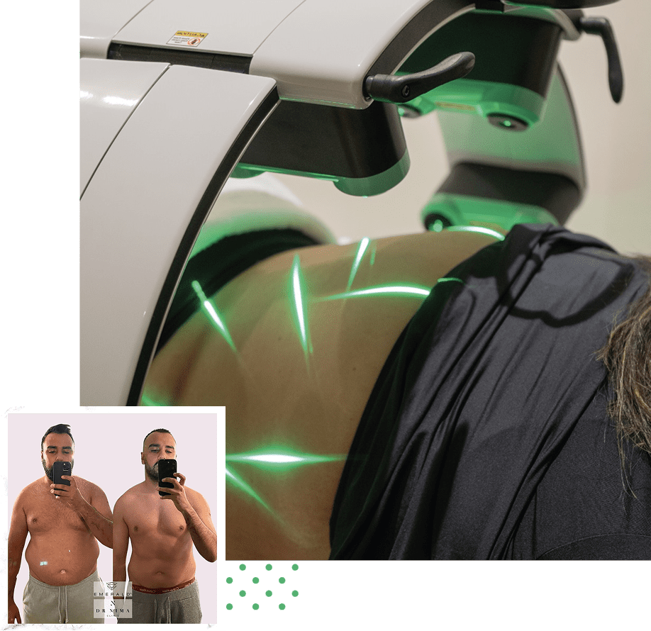 Body contouring treatment with before-and-after photos.