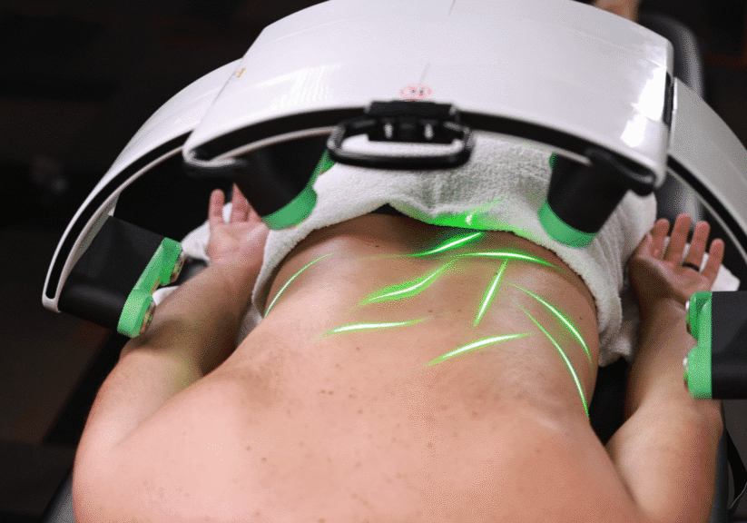 Person receiving laser treatment on back.